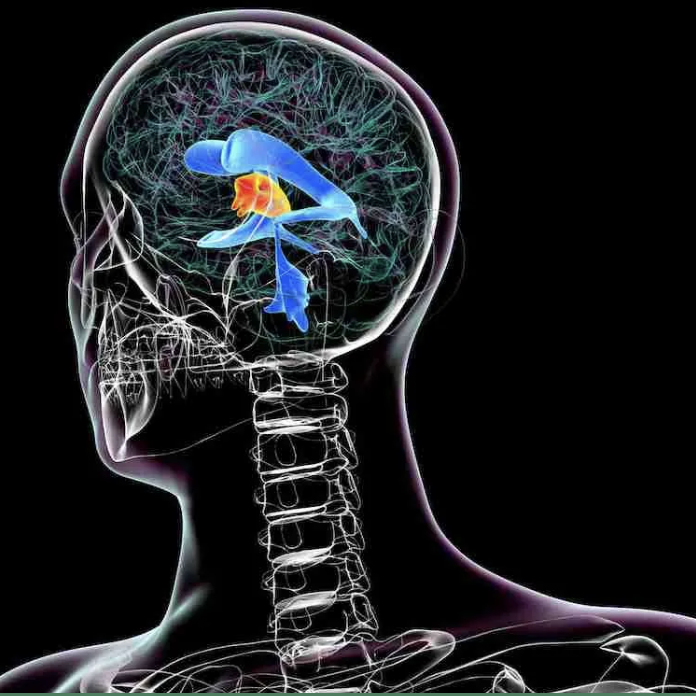 ESTENOSIS DE CANAL DOCTORA ESPINO NEUROCIRUJANO